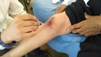 enfermeras, niñeras, ambulancia